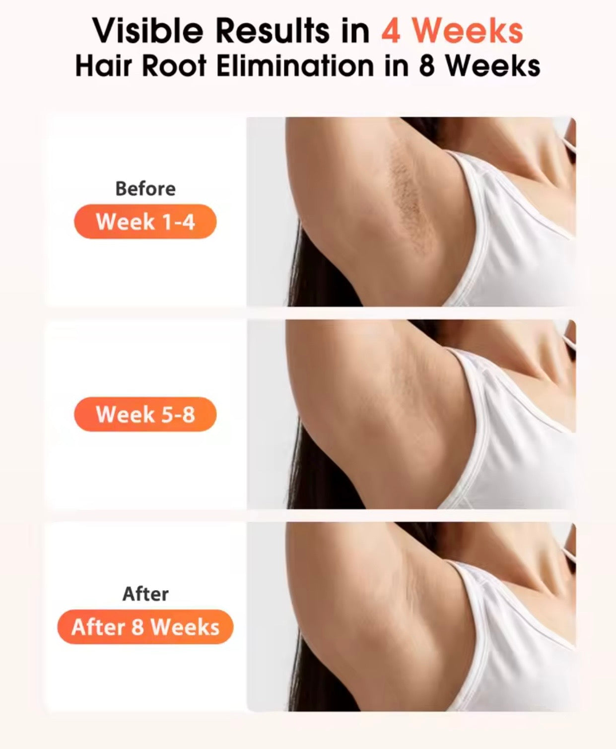 מכשיר לייזר להסרת שיער