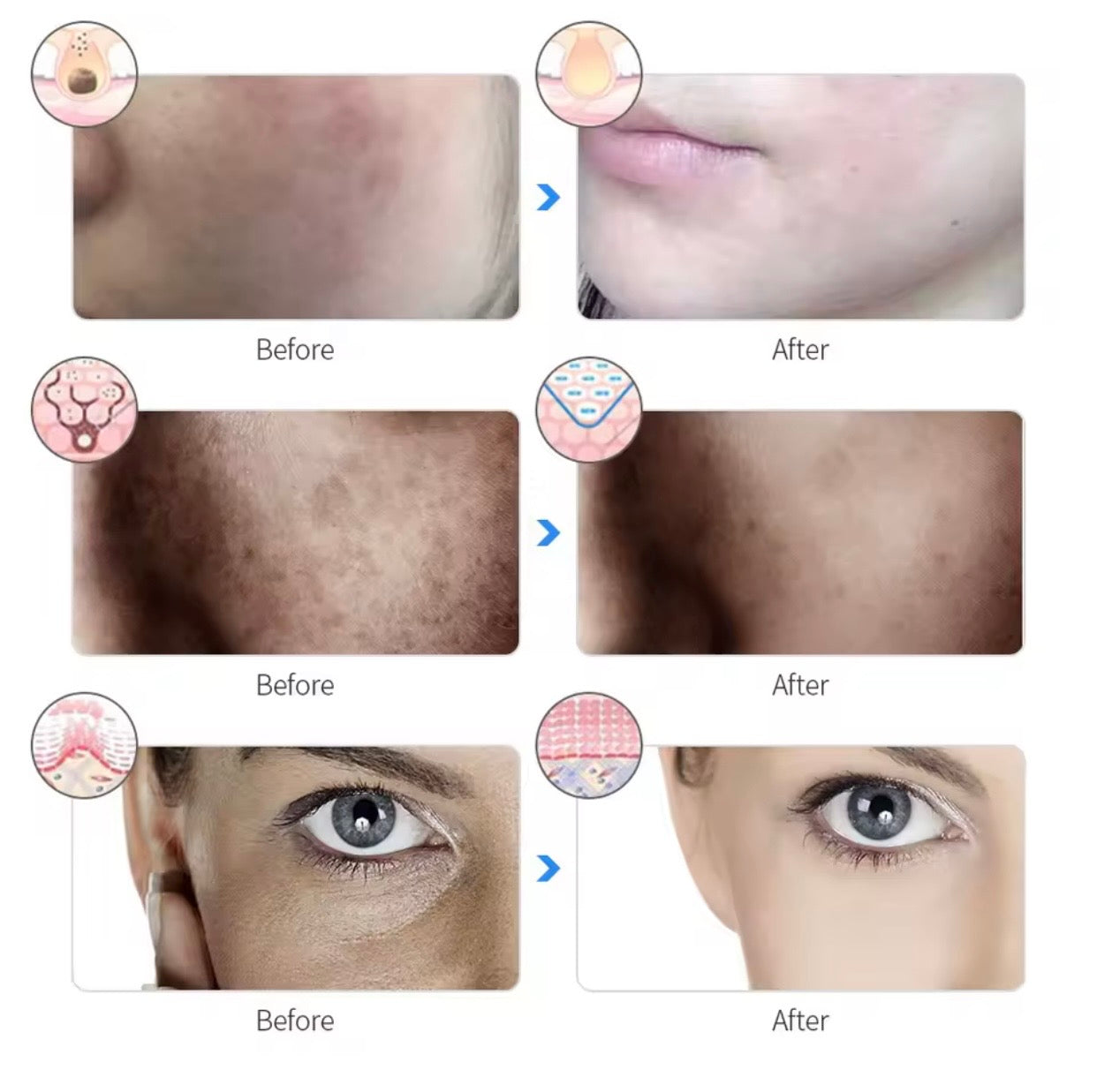 מסכת LED לפנים 7 צבעים